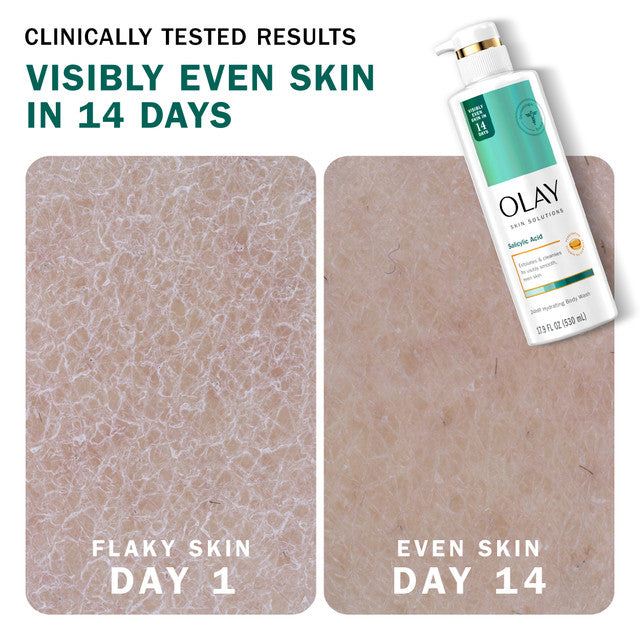 Olay Skin Solutions Women's Body Wash with Salicylic Acid, for All Skin Types, 17.9 fl oz
